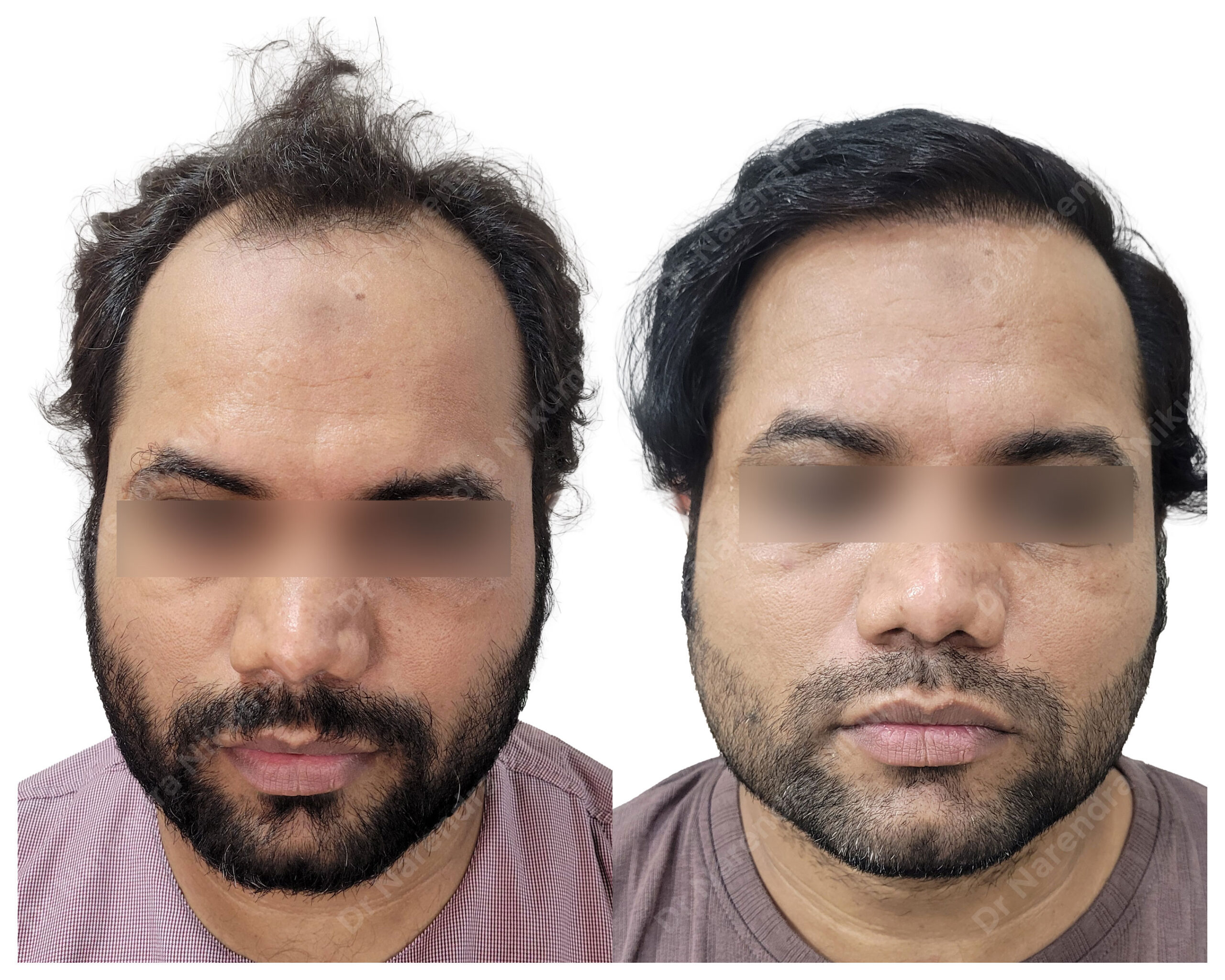 Aarif-Pathan-B&A-Masked