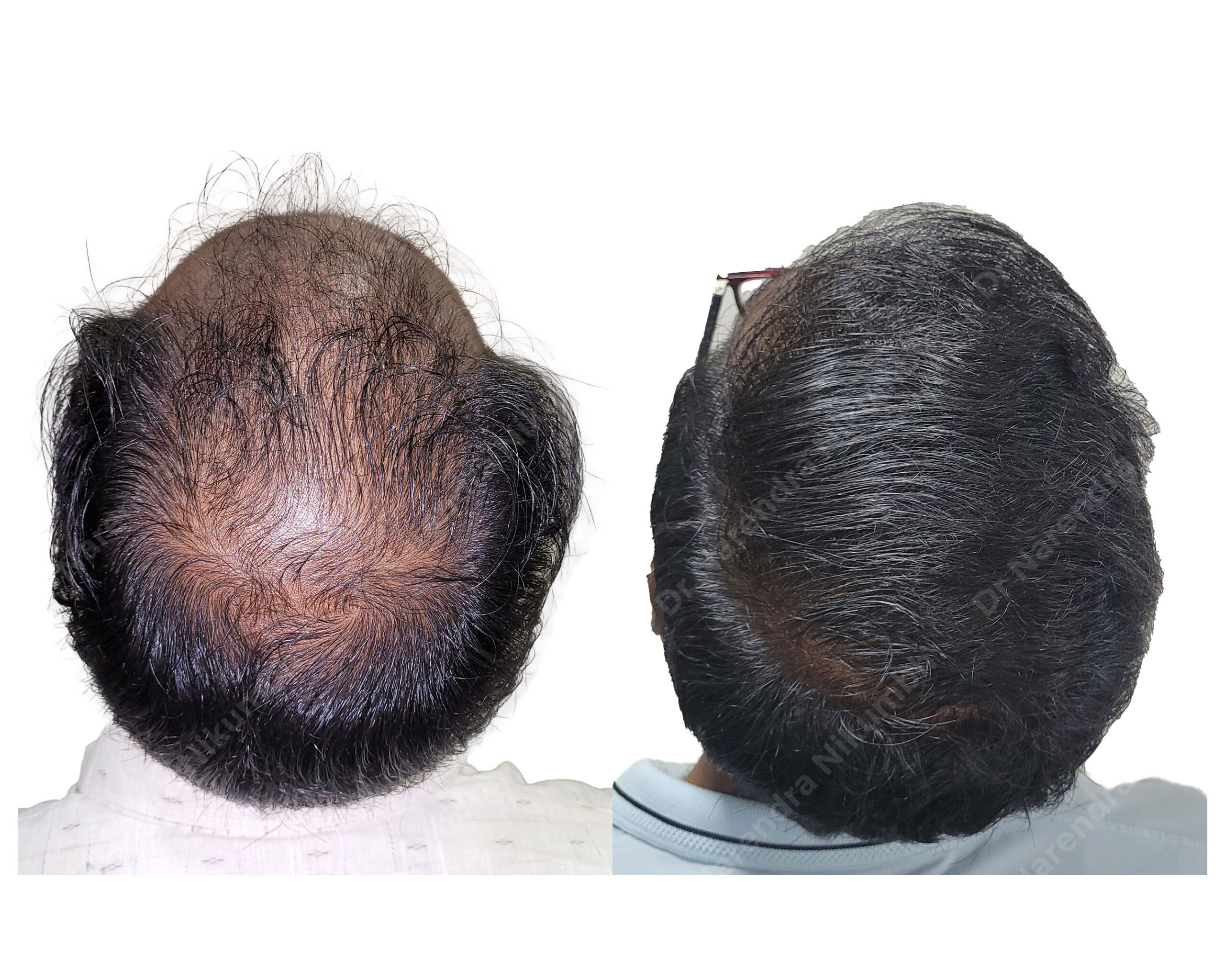 Abhay-Guddadnal-B&A-1-Masked
