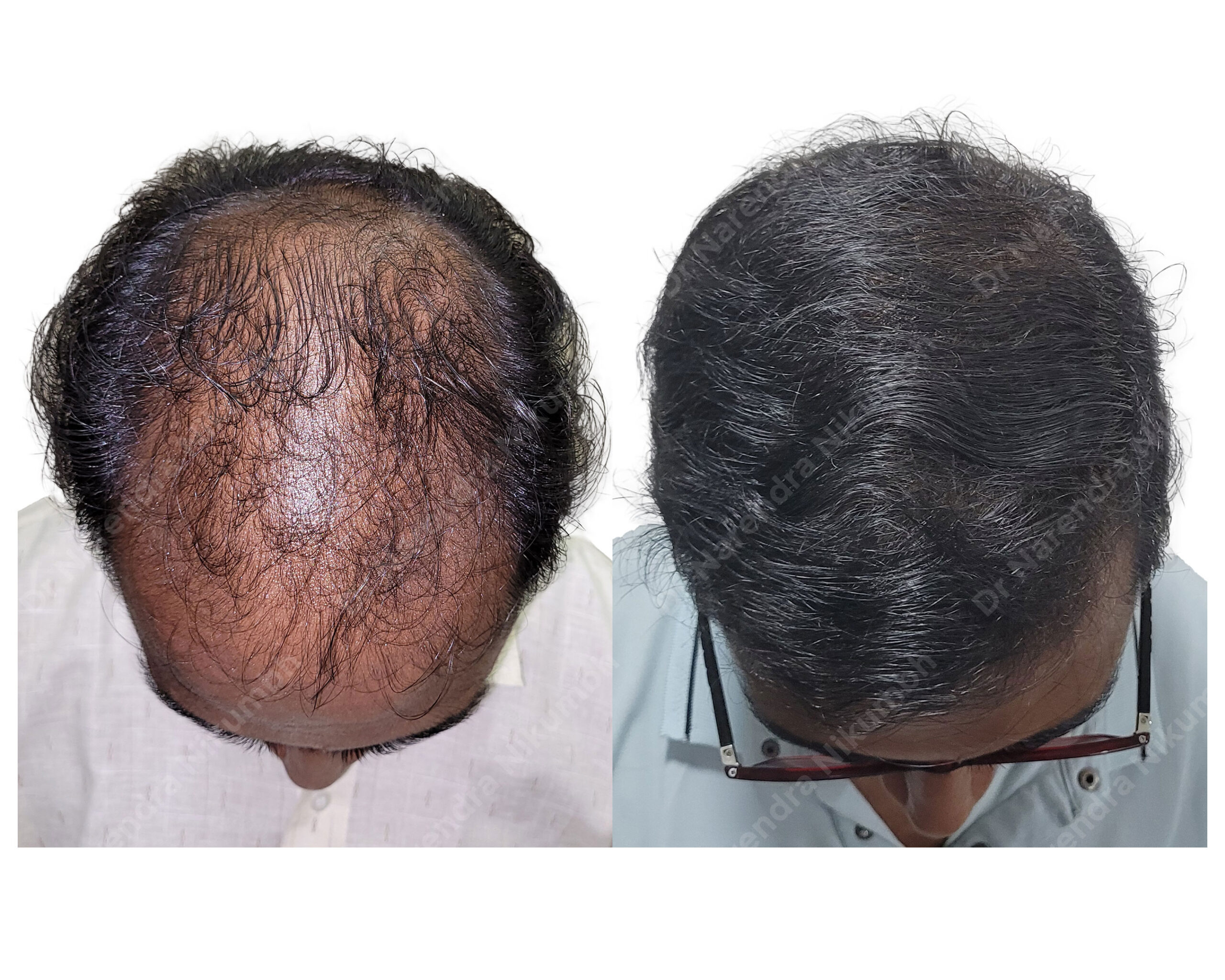 Abhay-Guddadnal-B&A-Masked
