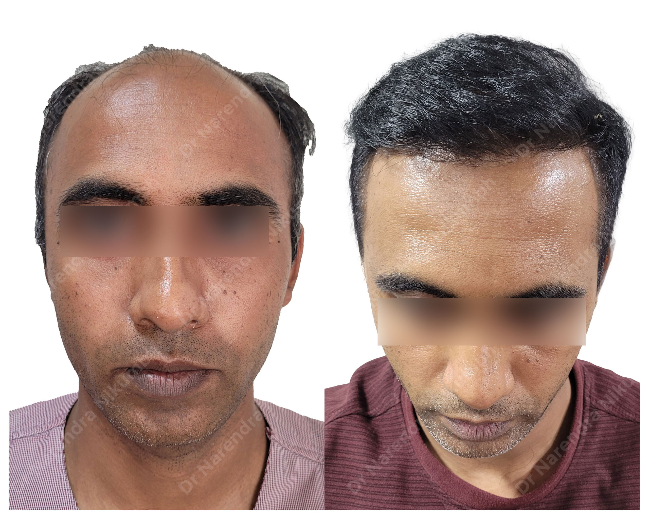 Abhay-Patil-B&A-1-Masked