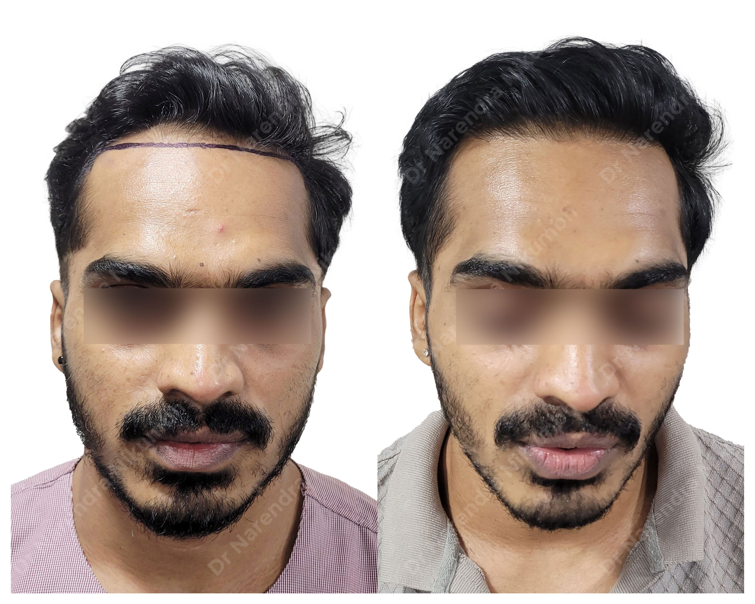 Akshay-Chaudhari-B&A-Masked