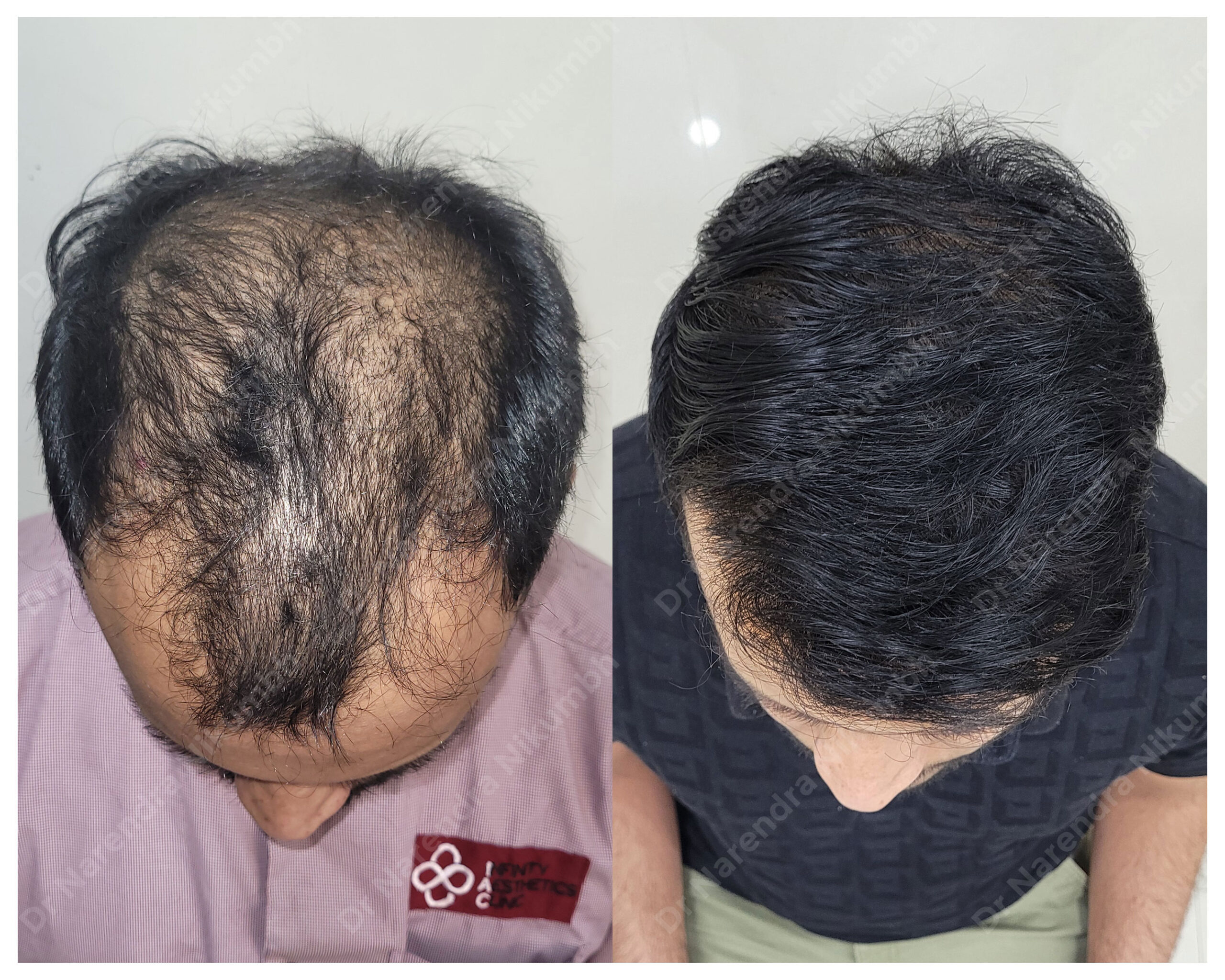 Farhan-Shaikh-B&A-Masked