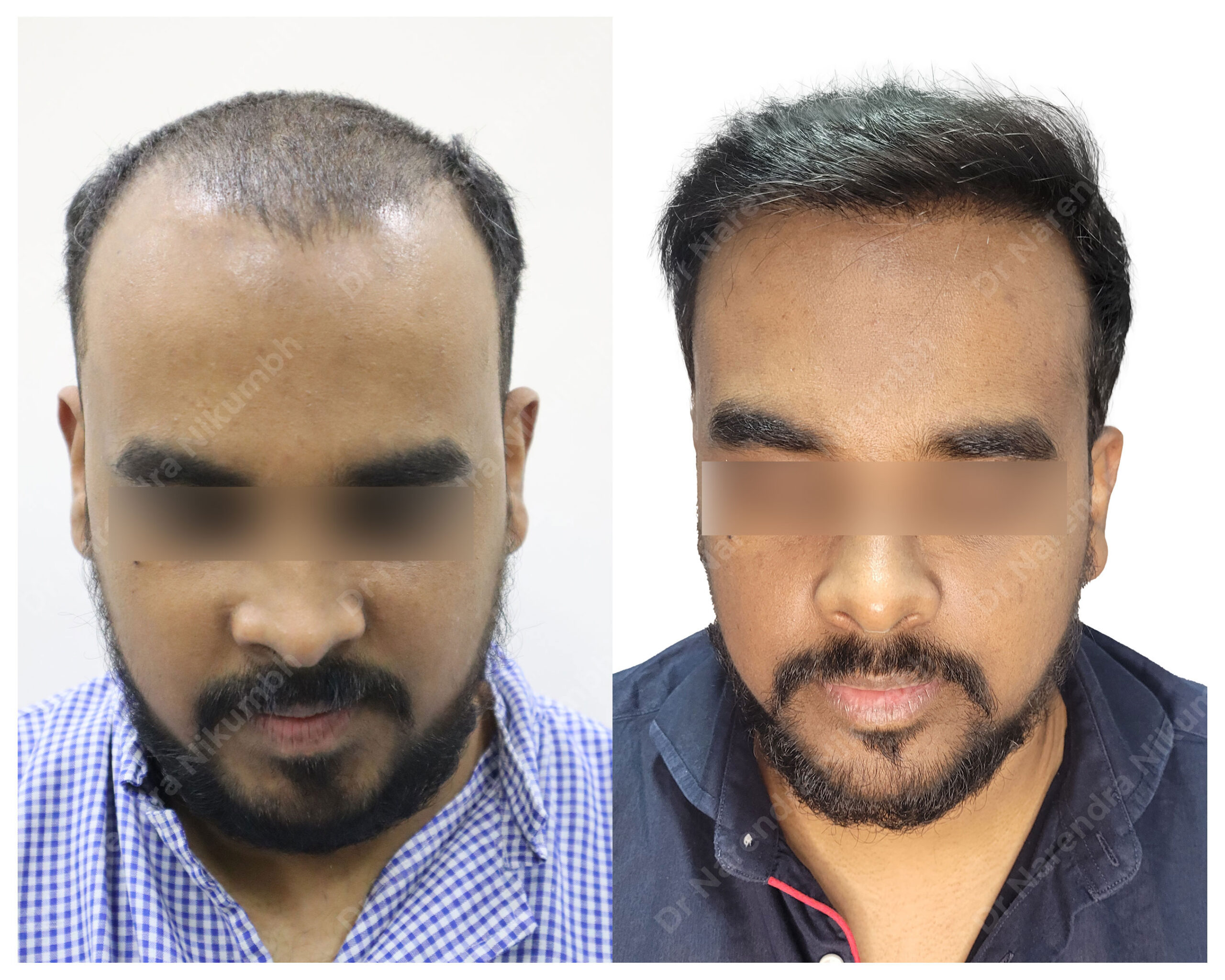 Feroz-Bhopalwala-B&A-Masked