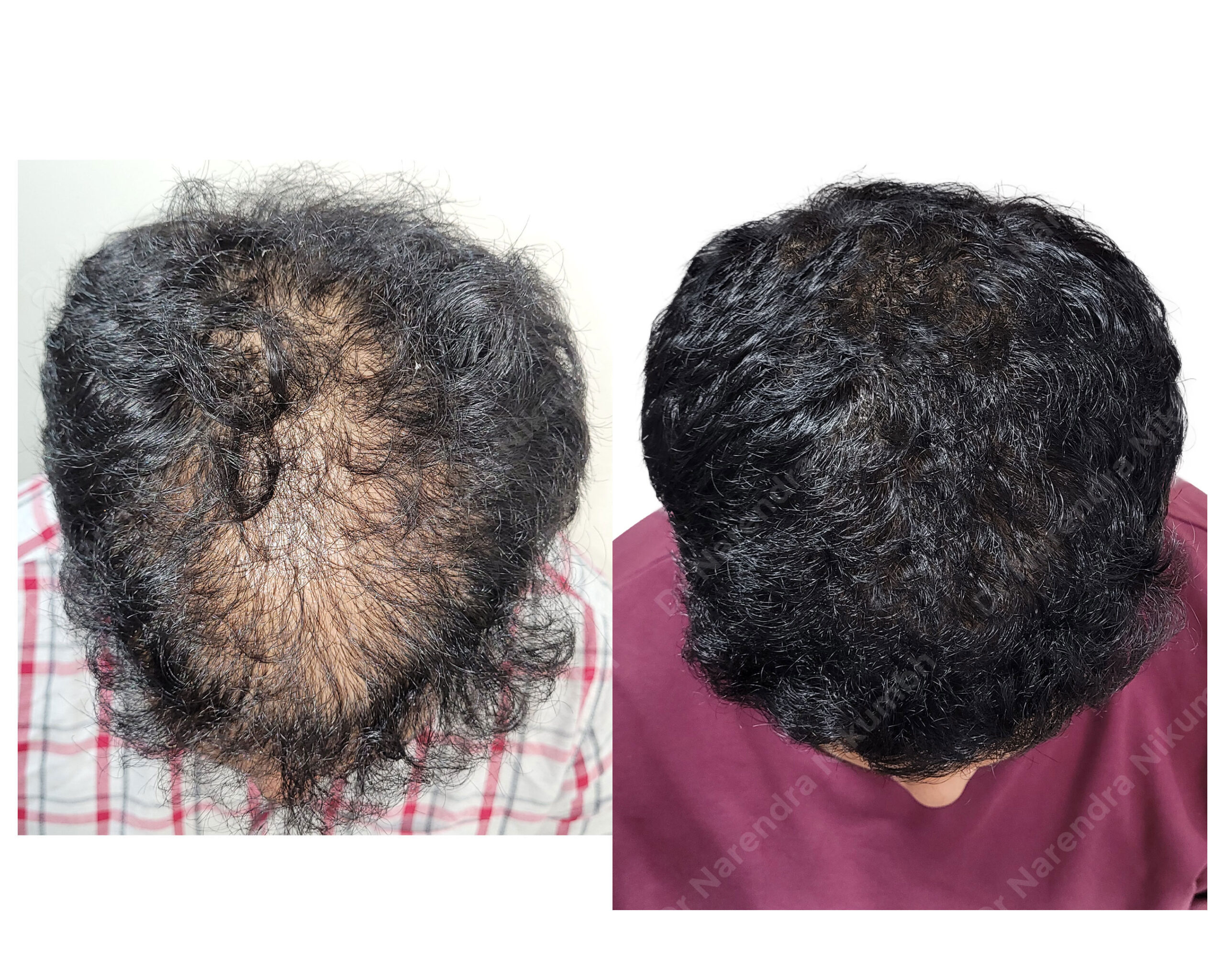 Jatin-Patil--B&A-Masked.-jpg
