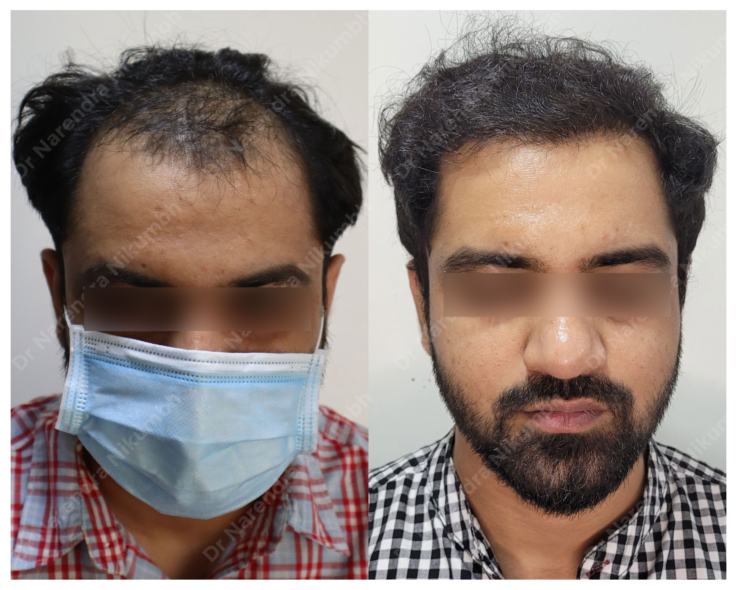 Karan-More-B&A-Masked