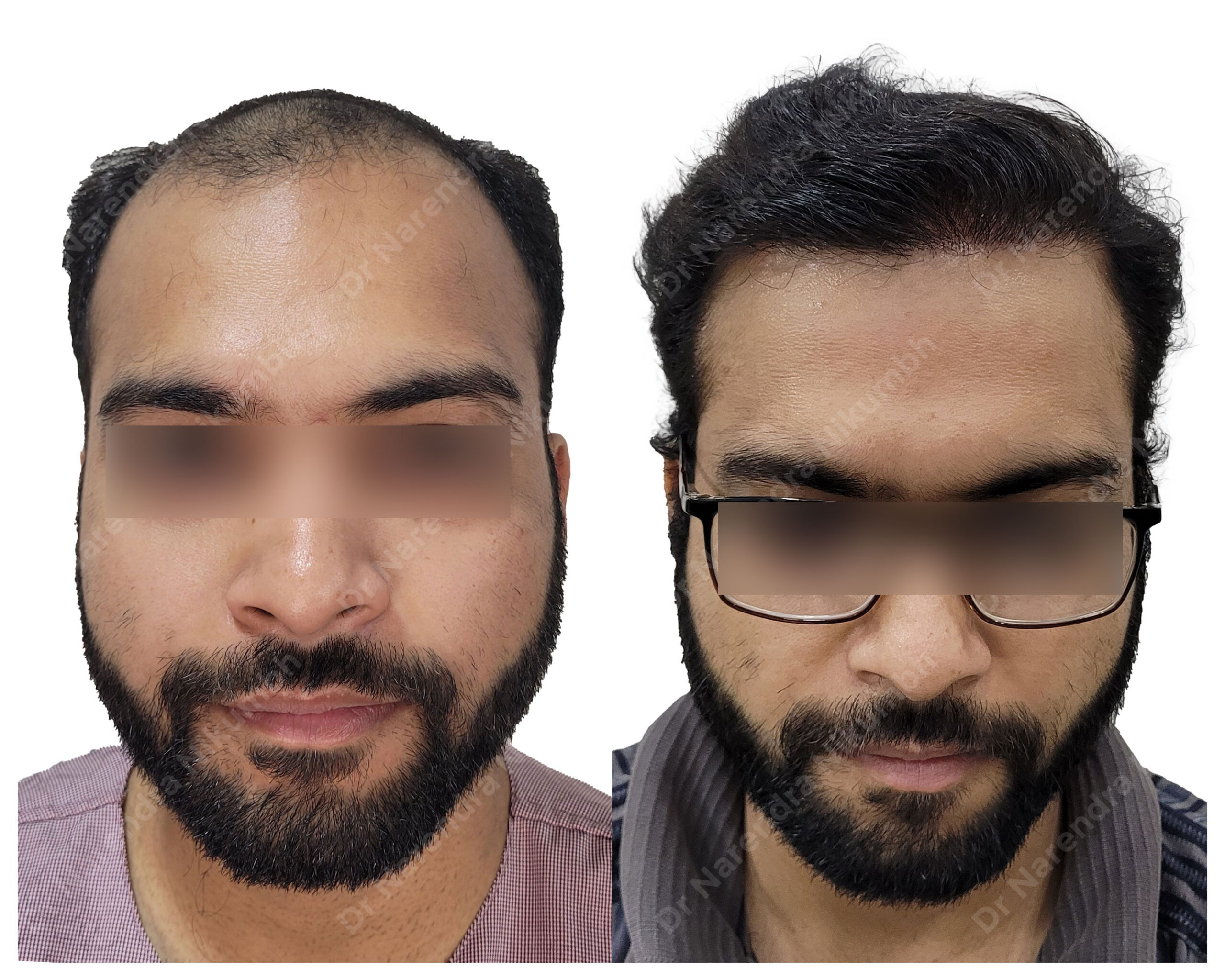 Kartk-More-B&A-Masked