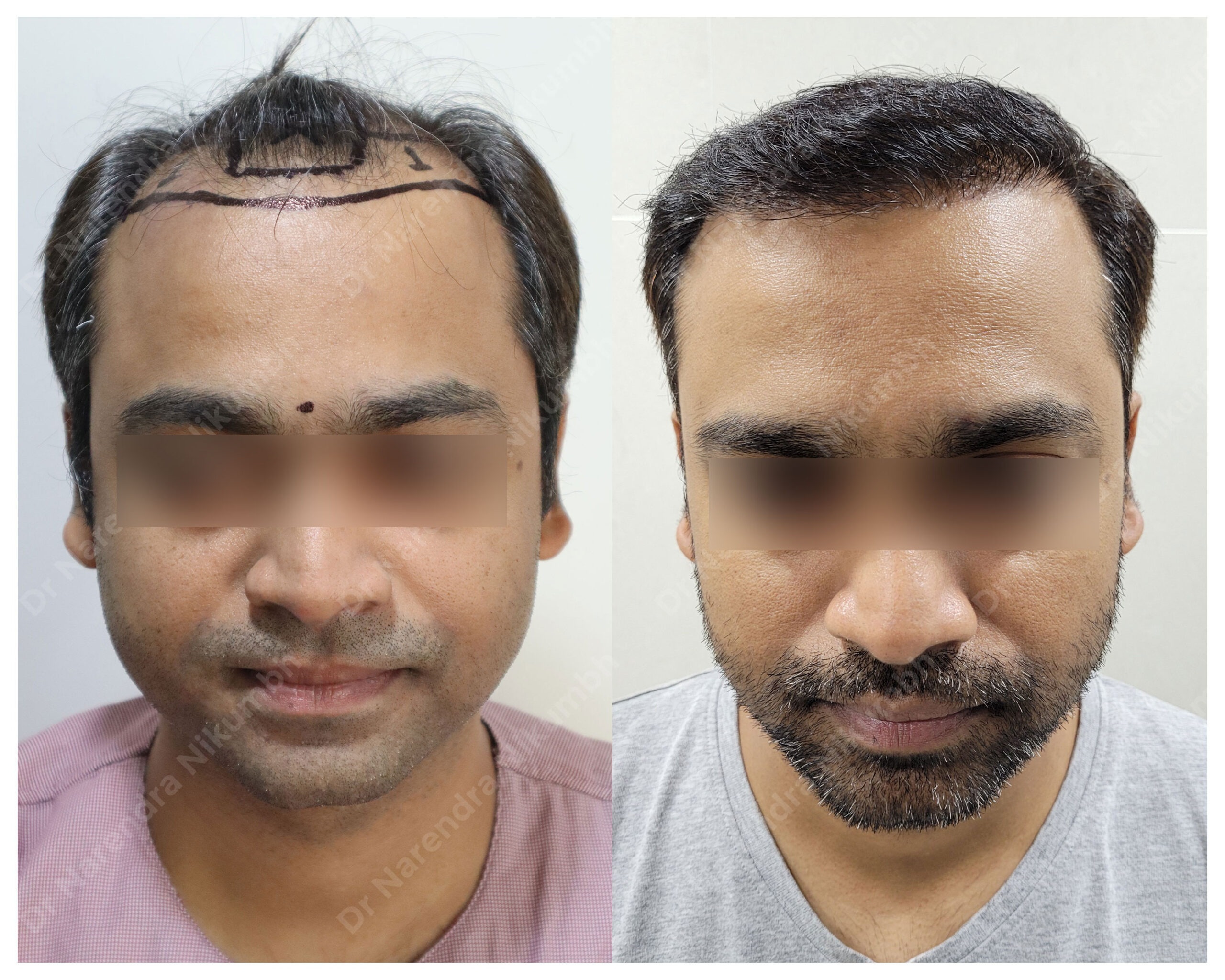 Mahesh-Gawade-B&A-masked