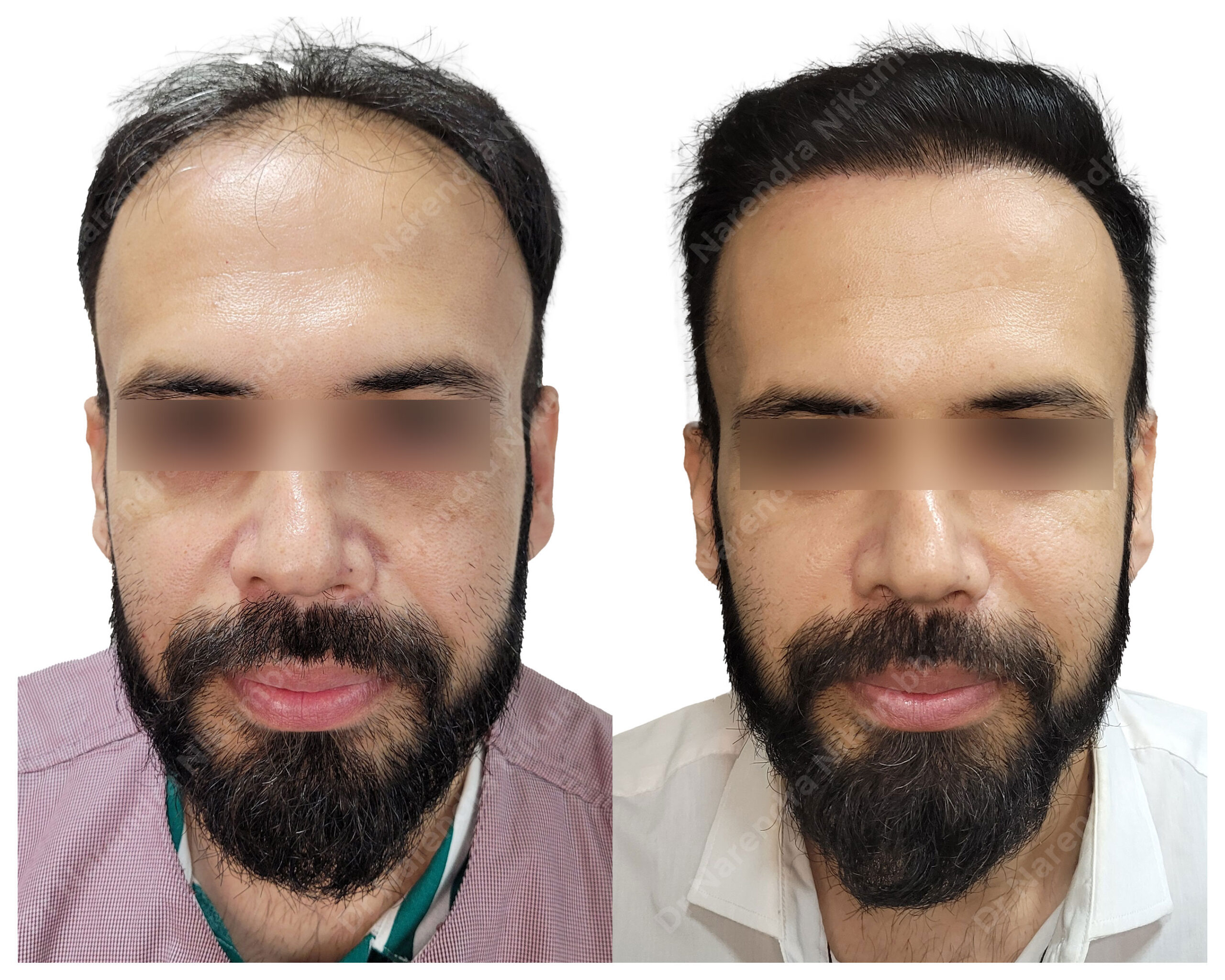 Nitin-Sharma-B&A-Masked