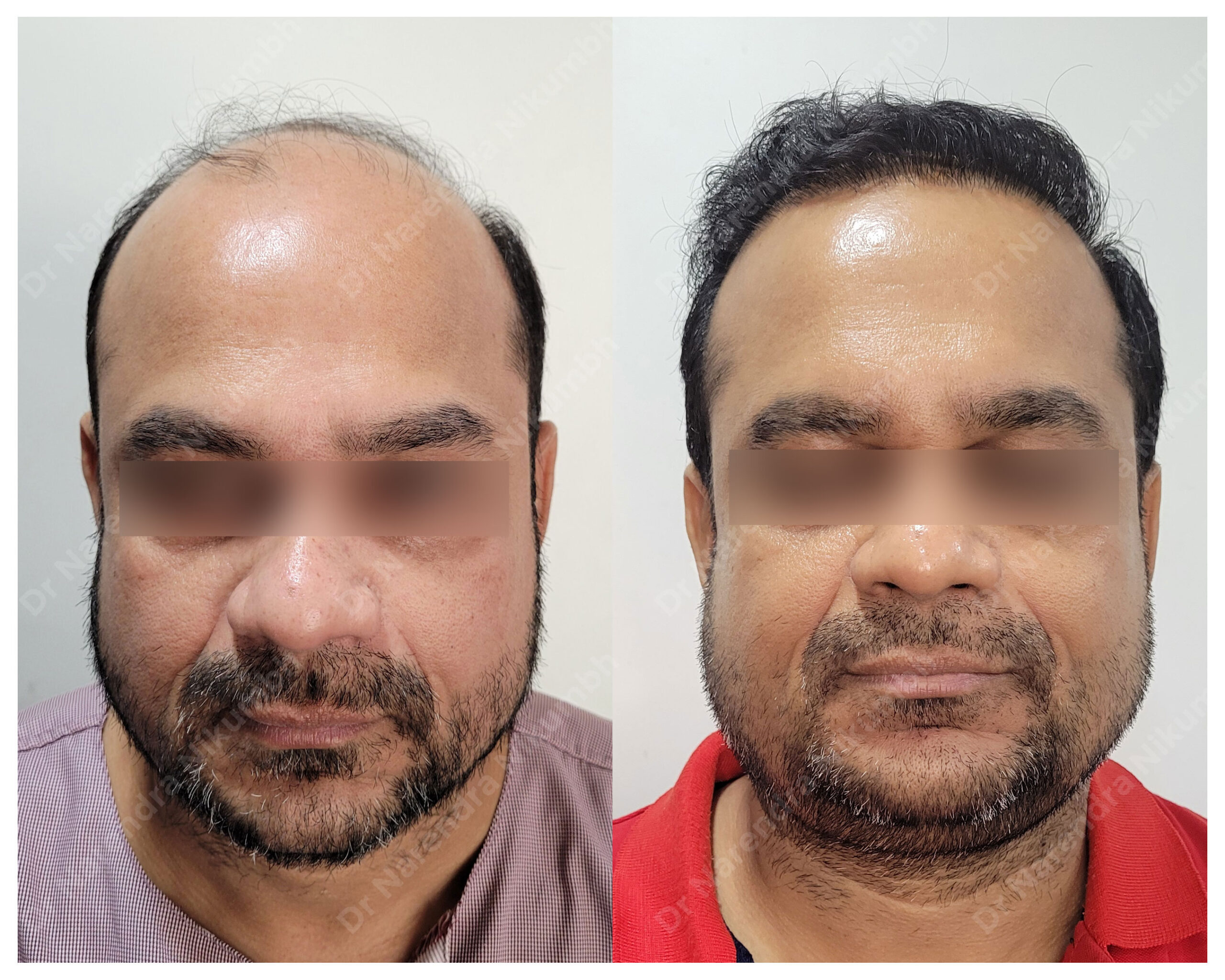 Pramod-Dwarpala-B&A-Masked