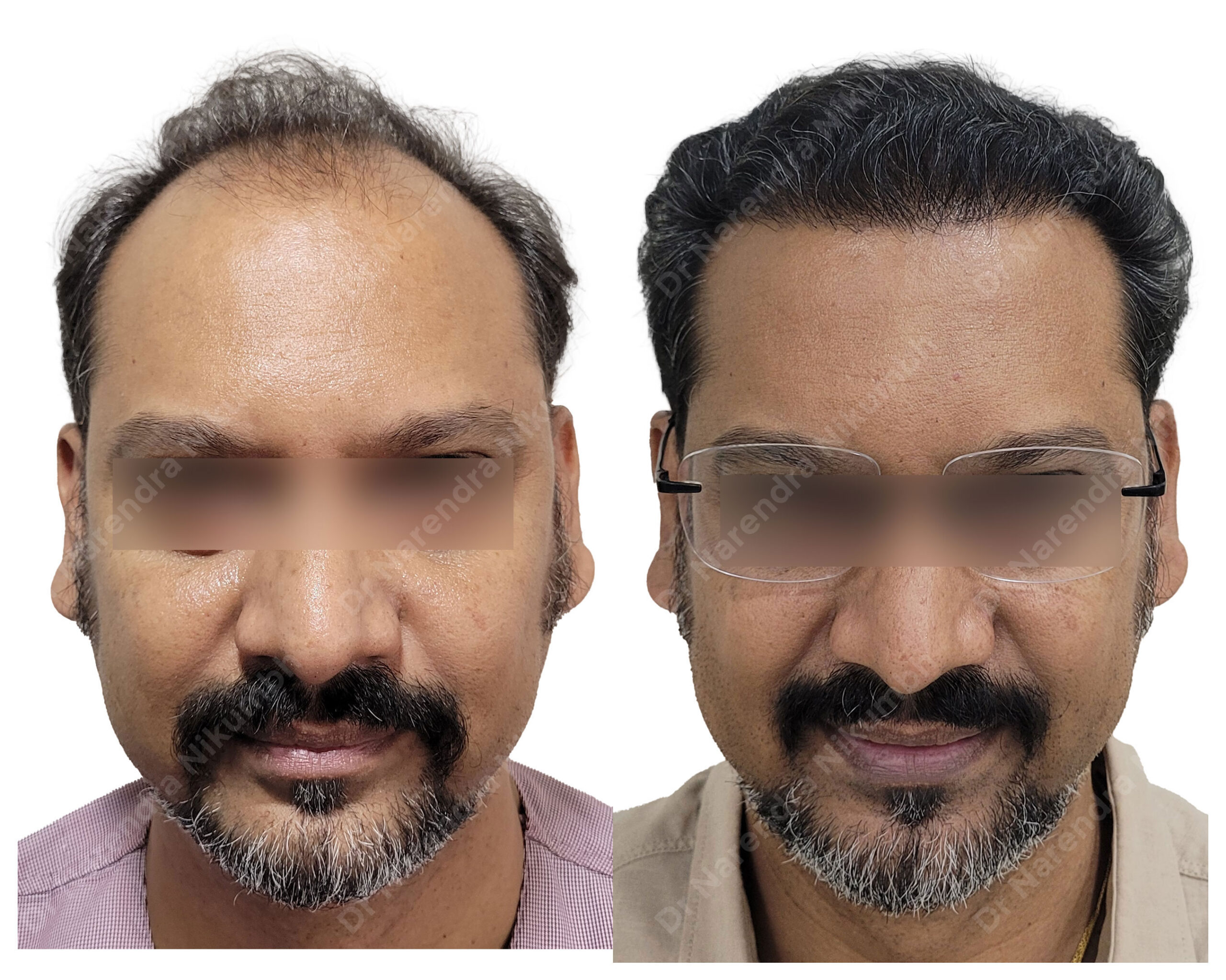 Pravin-More-B&A-Masked