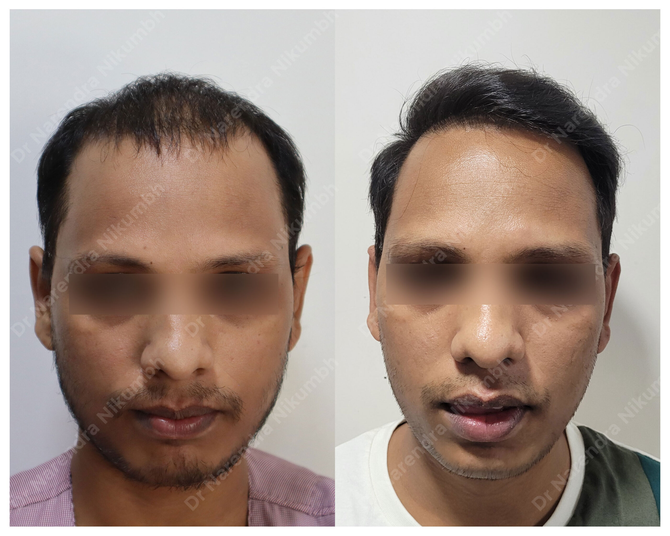 Prince-Dhingian-B&A-Masked