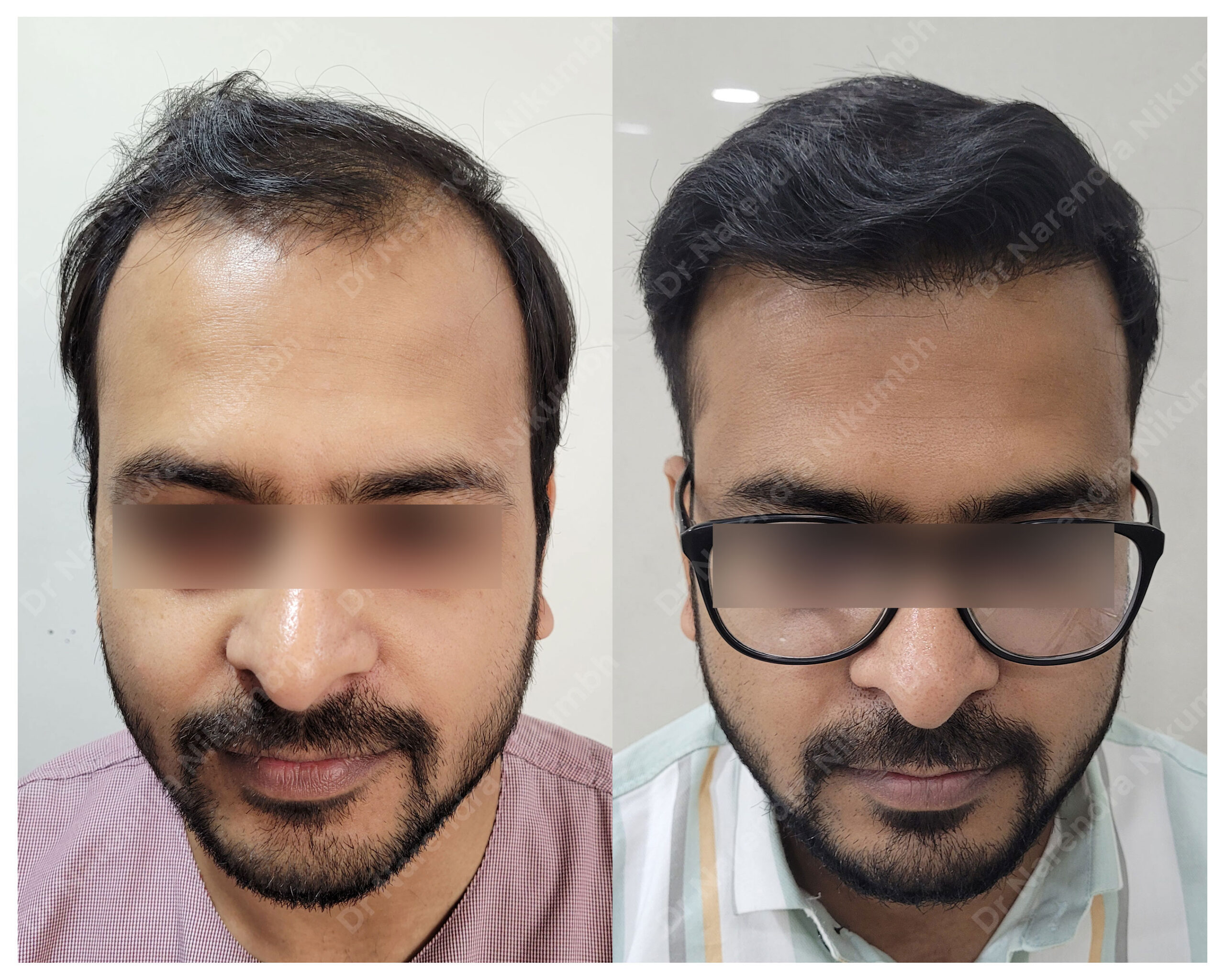 Ronak-Kucheria-B&A-Masked