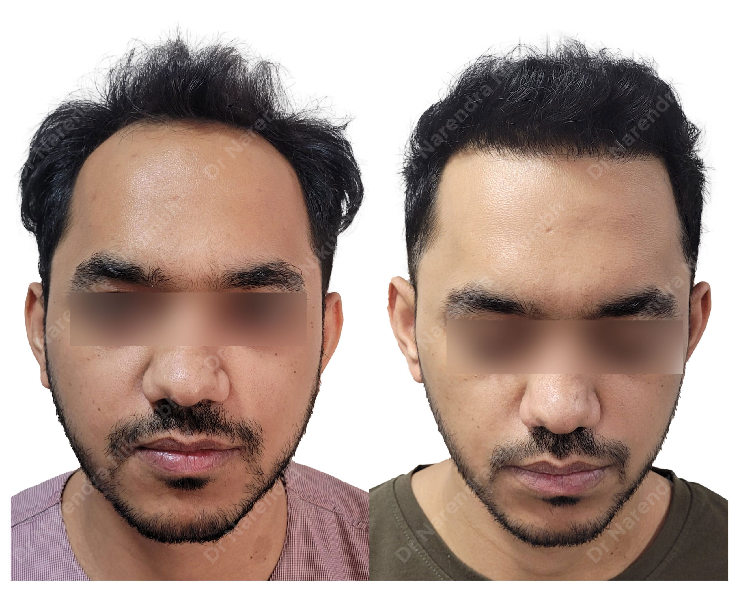 Shahab-Nachan-B&A-Masked