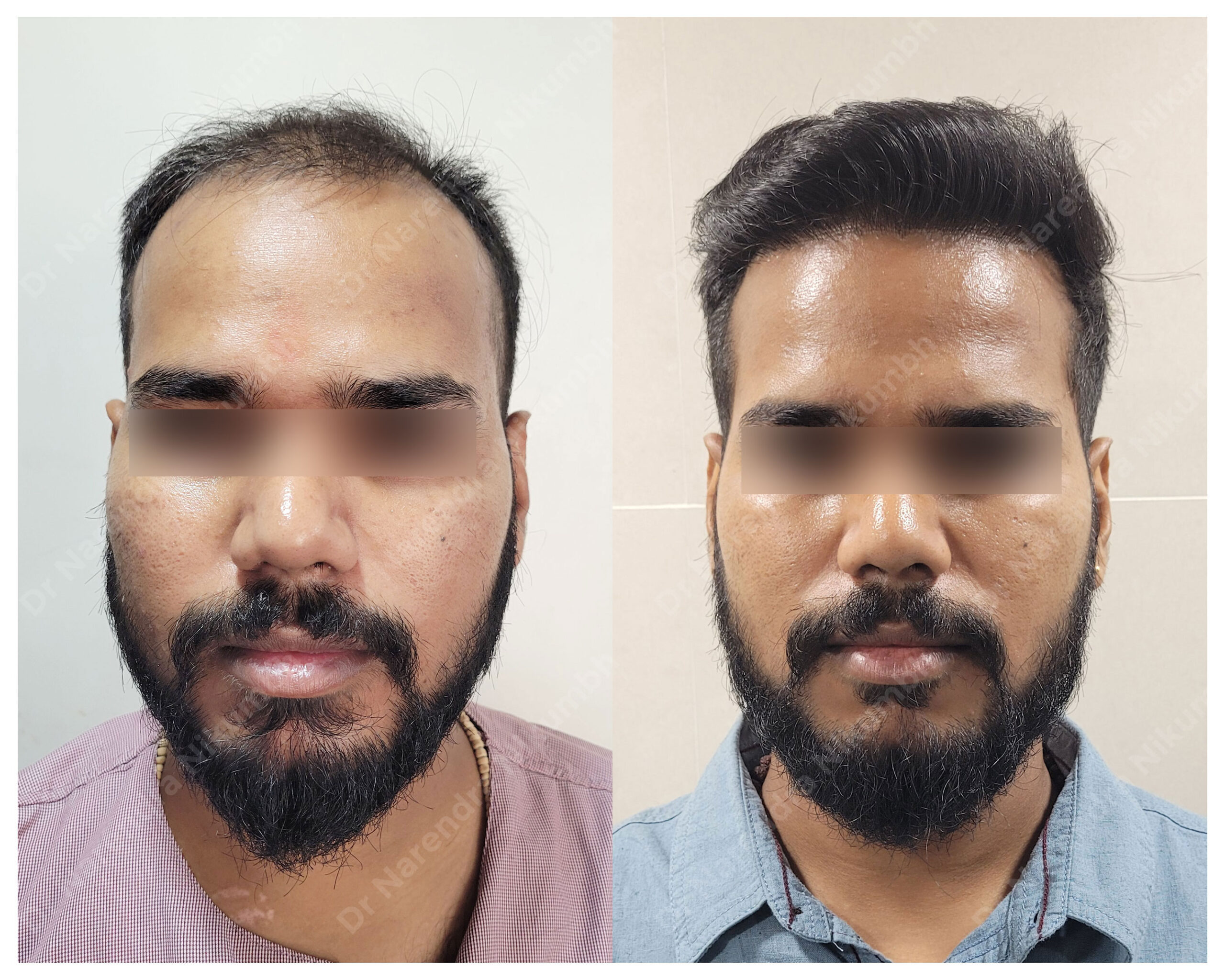 Tushar-Khode-B&A-Masked