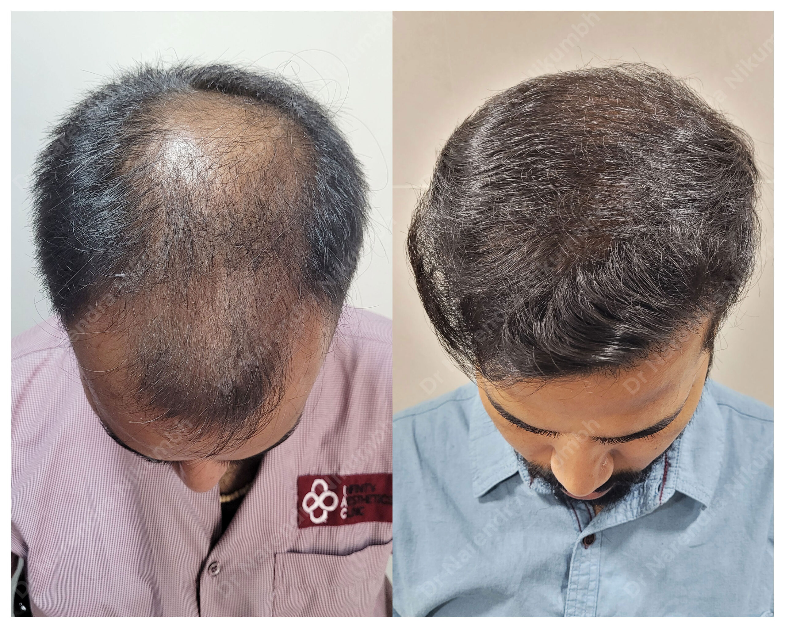 Tushar-Khode-Down-B&A-Masked