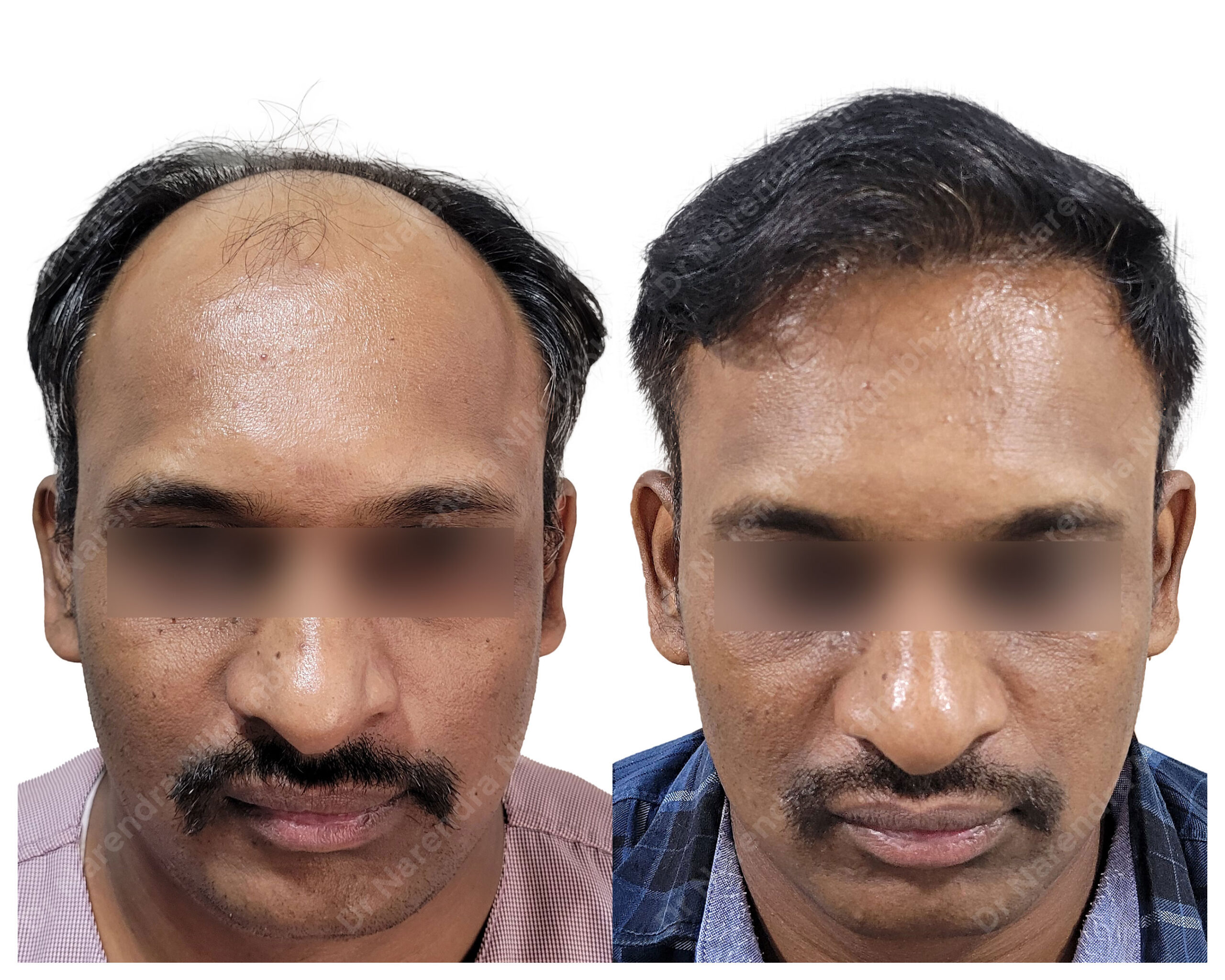 VIshwanath-Jadhav-B&A-Masked
